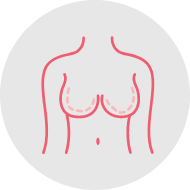 Breast augmentation mammoplasty