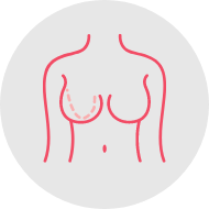 Breast reconstruction