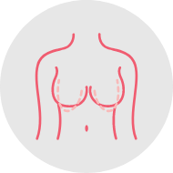 Breast reduction mammoplasty