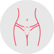 Labiaplasty