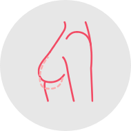 Lift and reduce size