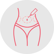 Liposuction