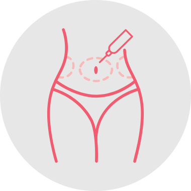 Liposuction