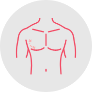 Treat gynaecomastia