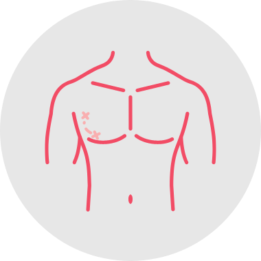 Treat gynaecomastia