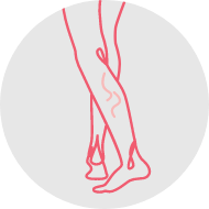 Minimise-varicose-veins-img