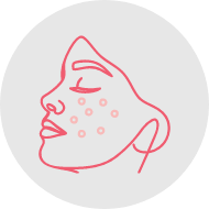 Reduce-acne-scarring-img