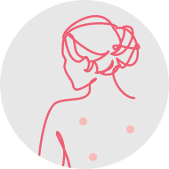 Vascular Lesions and Cherry Angioma’s
